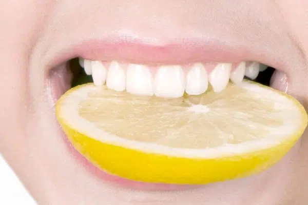 Comment avoir les dents blanches naturellement ?