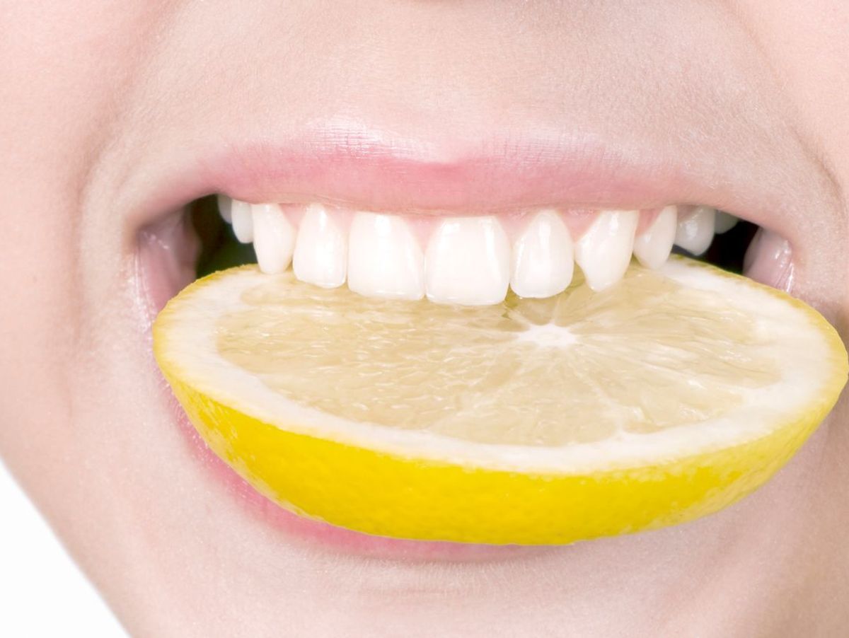 Comment avoir les dents blanches naturellement ?